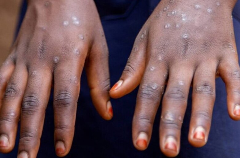 970×546-670920ee2f77d670920ee2f77e